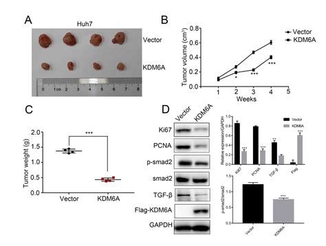kdm6a suppresses hepatocellular carcinoma cell proliferation by negatively regulating the tgf‑β