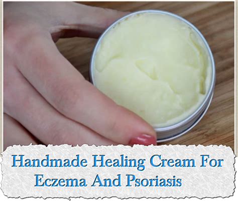 How To Treat Eczema With Oil Lotion And Cream