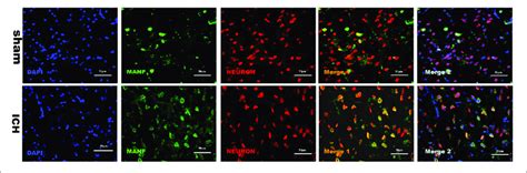 Representative Microphotographs Of Immunofluorescence Staining