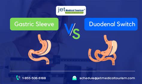 Gastric Sleeve Vs Duodenal Switch Jet Medical Tourism In Mexico