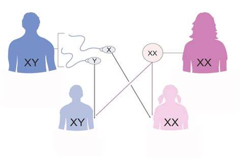 Symptoms Of Klinefelter Syndrome Diagram