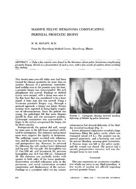 Massive Pelvic Hematoma Complicating Perineal Prostatic Biopsy