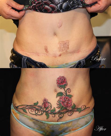 In this gallery you'll find some unbelievable work that is downright inspiring. Surgical Scar Coverup Tattoo by danktat on DeviantArt