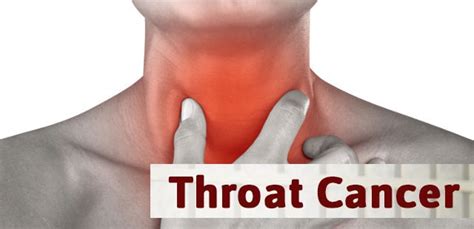 Throat Cancer 6 Of The Most Common Symptoms Of Throat Cancer That You