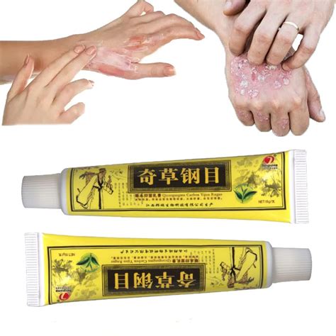 Natural Chinese Herbal Eczema Psoriasis Creamsnatural Chinese Herbal