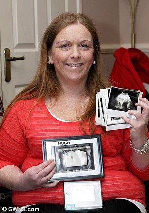 Woman Born With TWO Wombs And TWO Vaginas Gives Birth To A Miracle
