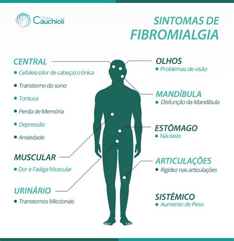 Conheça Os Sintomas Da Fibromialgia Clínica Cauchioli