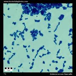 Enterococcus Faecalis Under Microscope Microscopy Of Gram Positive
