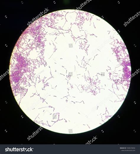 Bacillus Subtilis Gram Stain Under 40 Stock Photo 1908578050 Shutterstock