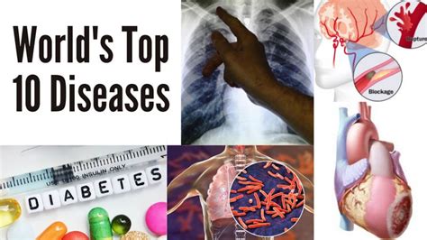 Worlds Top 10 Deadliest Diseases World Gulf News