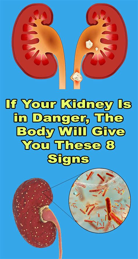 If You Kidney Is In Danger The Body Will Give You These 8 Signs