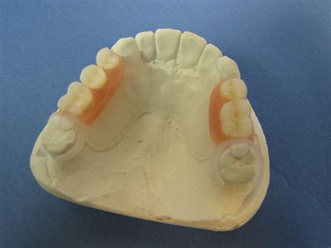 Partials And Dentures Zedan Dental Lab