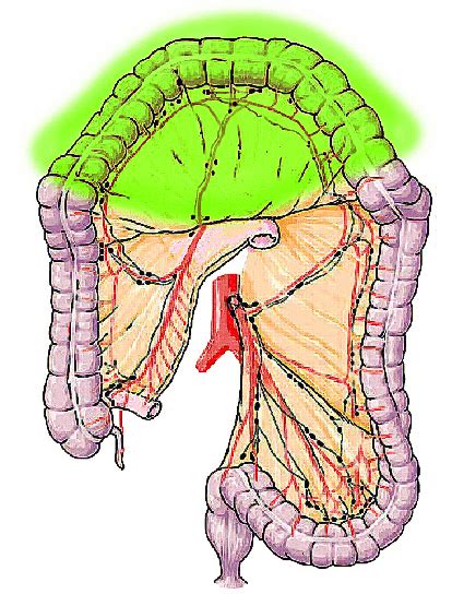 Anatomical Representation Of Tc Tc Transverse Colectomy Download