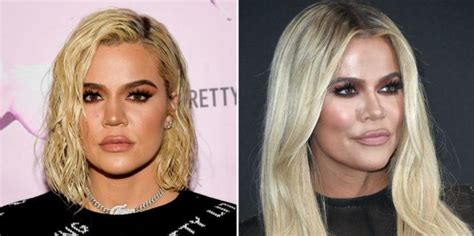 Khloe kardashian before and after photos. Did Khloé Kardashian Get A Nose Job? Before/After Photos ...
