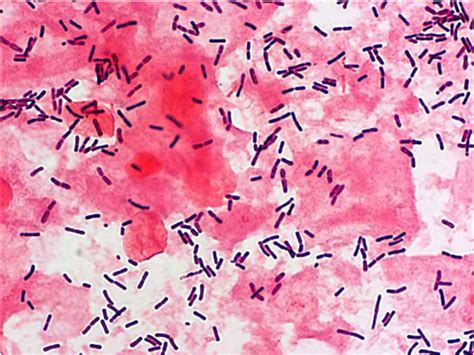 Filebacteria Gram Stained Vaginal Smear 01 Embryology