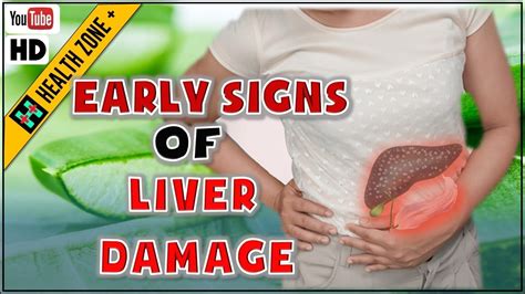 6 Early Signs Of Liver Damage Symptoms To Know Youtube