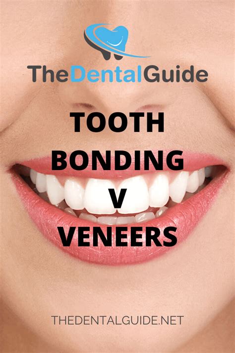Tooth Bonding V Veneers The Dental Guide
