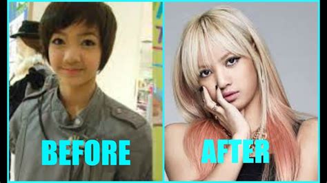 Before And After Kpop Plastic Surgery