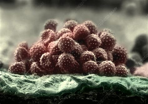 Fungal Spores Sem Stock Image B2500994 Science Photo Library
