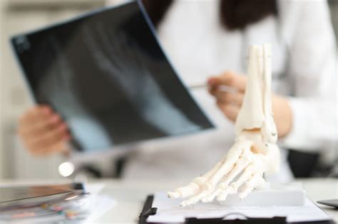 Doctor Holds Xray Of Foot And Anatomy Of Bones Of Leg 照片檔及更多 創傷學 照片