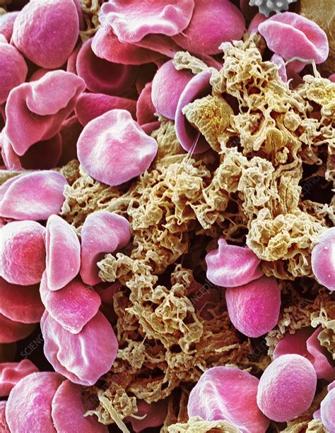 Red Blood Cells And Platelets Sem Stock Image F0131521 Science