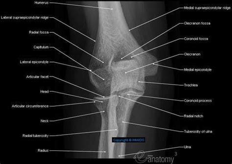 Elbow Radiography Anterior Posterior View Lateral Epicondyle