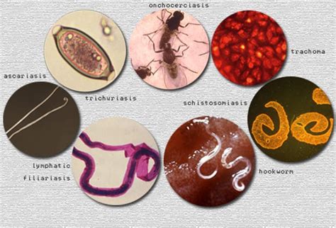 The Most Neglected Tropical Diseases That You Should Know About