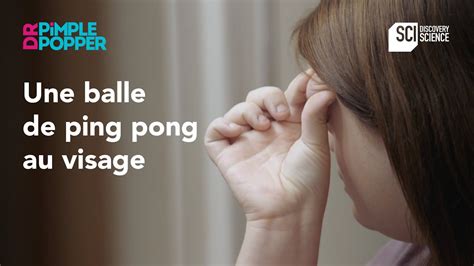 Une Balle De Ping Pong Au Visage Dr Pimple Popper Youtube