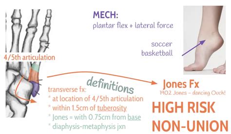 Emdocs Net Emergency Medicine Educationem In Th Metatarsal Fractures Emdocs Net