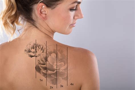 Agregar más de 63 se puede exfoliar un tatuaje netgroup edu vn