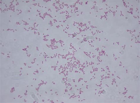 How to Treat Klebsiella Pneumoniae Bacteria Infections?