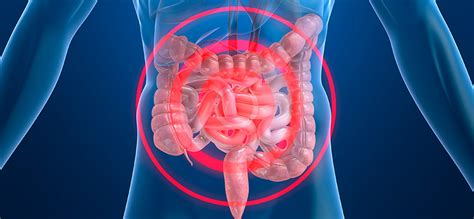 Según la comunidad científica la enfermedad de Crohn se ha ...