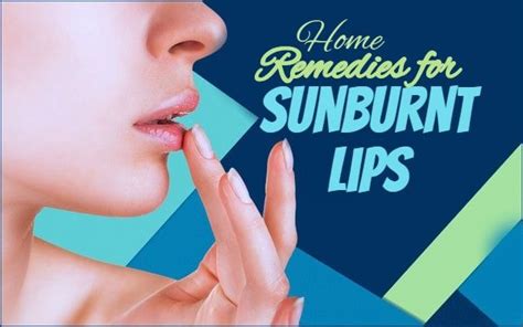 Top 12 Home Remedies For Sunburnt Lips No5 Will Shock You