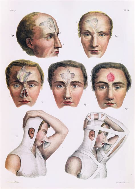 An Old Medical Illustration Shows The Different Facial Shapes And Types