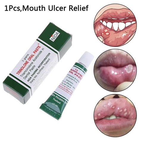 Mouth Ulcer Relief Gel Natural Herbal Oral Antibacterial Cream Fast