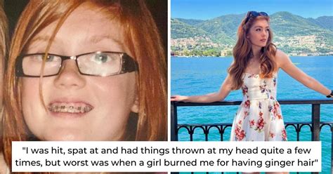 Woman Who Was Bullied In School For Being Ginger Grows Up To Be First