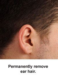 There are usually two different types of ear hair. FAQ's: Permanent Hair Removal