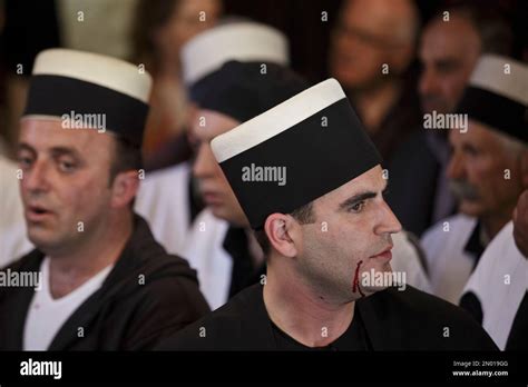 Blood runs from a cheek of a Kosovo dervish, follower of Sufism a