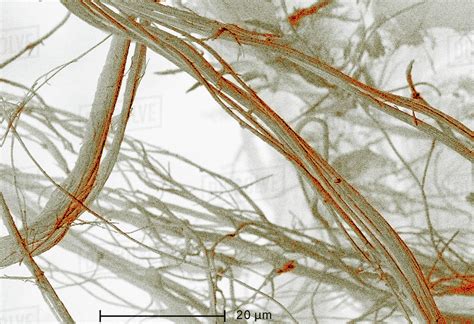 Scanning Electron Micrograph Of Asbestos 1500x Stock Photo Dissolve
