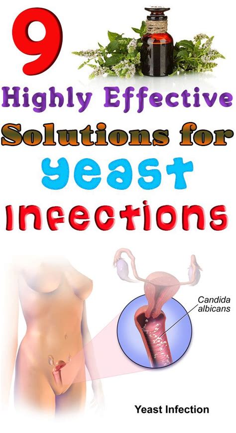 9 Highly Effective Solutions For Yeast Infections