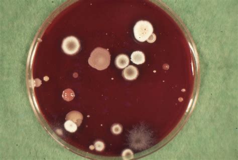 Keressen salmonella enteritidis bacterial colonies on blood témájú hd stockfotóink és több millió jogdíjmentes fotó, illusztráció és vektorkép között a shutterstock gyűjteményében. Blood Agar Plate. The results after incubation of a blood ...