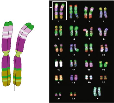 Lista 96 Foto Tipos De Cromosomas Segun El Centromero Mirada Tensa 092023