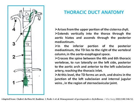 Thoracic Duct Embolization With Coils And Glue To Treat Post