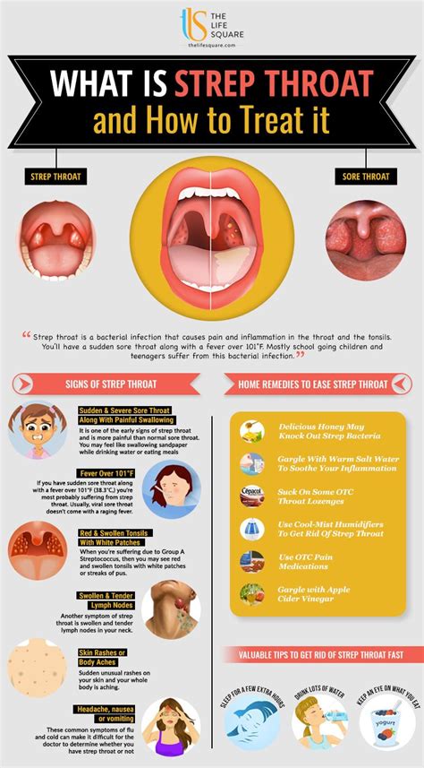 Strep A Throat Infection Symptoms