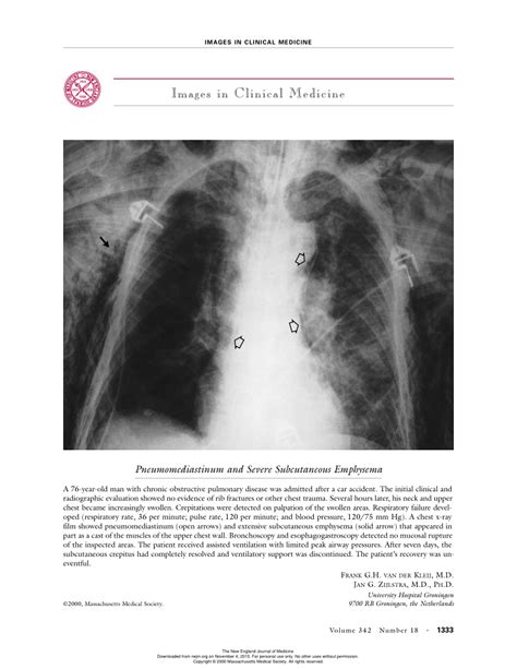 PDF Pneumomediastinum And Severe Subcutaneous Emphysema