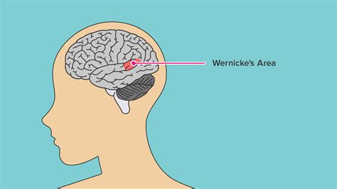 Wernickes Aphasia Symptoms Causes And Treatment