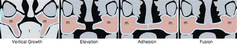 5 Coronal View Of A Normal Palate Shelf And The Key Stages Of Mouse
