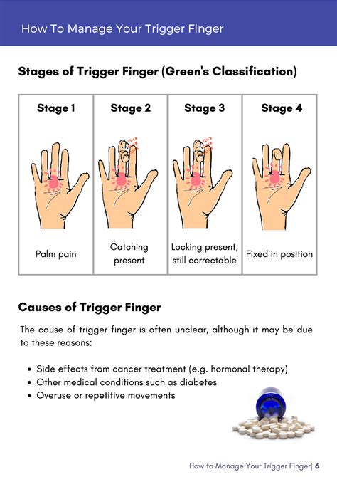 How To Manage Your Trigger Finger