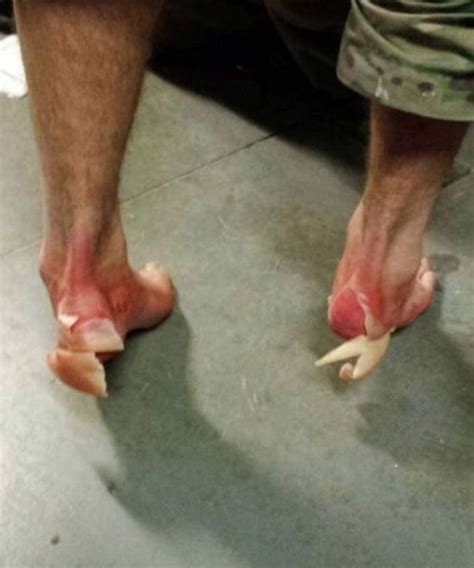 Either according to the airfare or according to the flying distance and the booking class. See What The Feet Of A US Marine Look Like After Walking ...