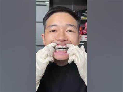 Диета малышевой щетка курица Зубная щетка, которой 7000 лет vs современна щетка! - YouTube Зубная щетка, которой 7000 лет vs современна щетка! - YouTube Диета малышевой щетка курица